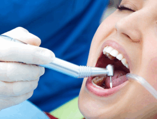 Root Canal Root Canal