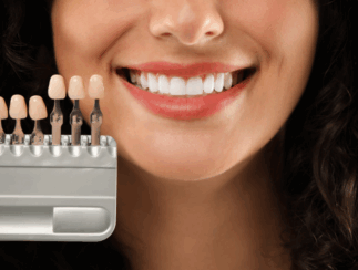 hollywood smile hollywood smile