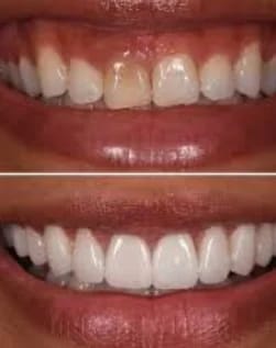 image-251x317-1.png (1)