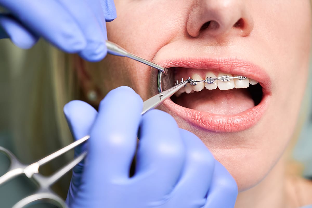 /orthodontics-braces